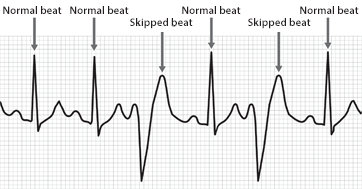 Optimal Heart Rates for Different Fitness Activities - EZON Watch